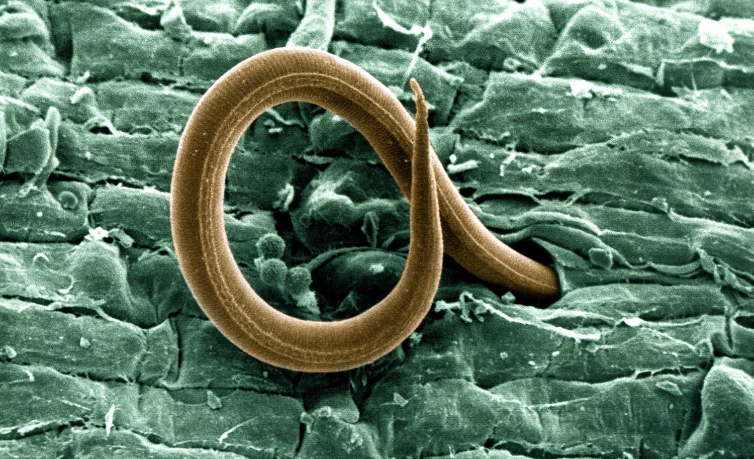 SEM foto van een nematode die een wortelknop penetreert.