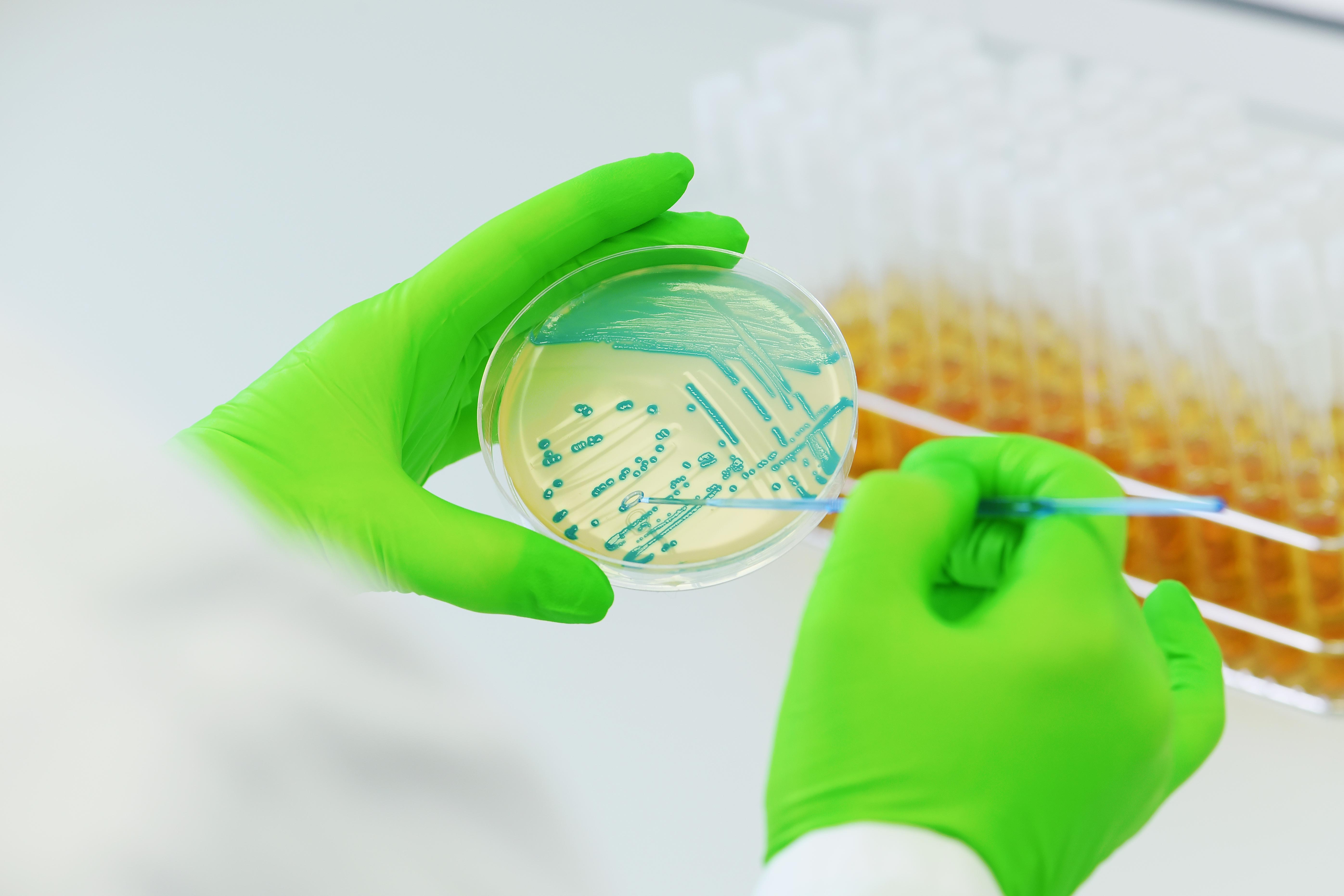 microbiologie analyse 