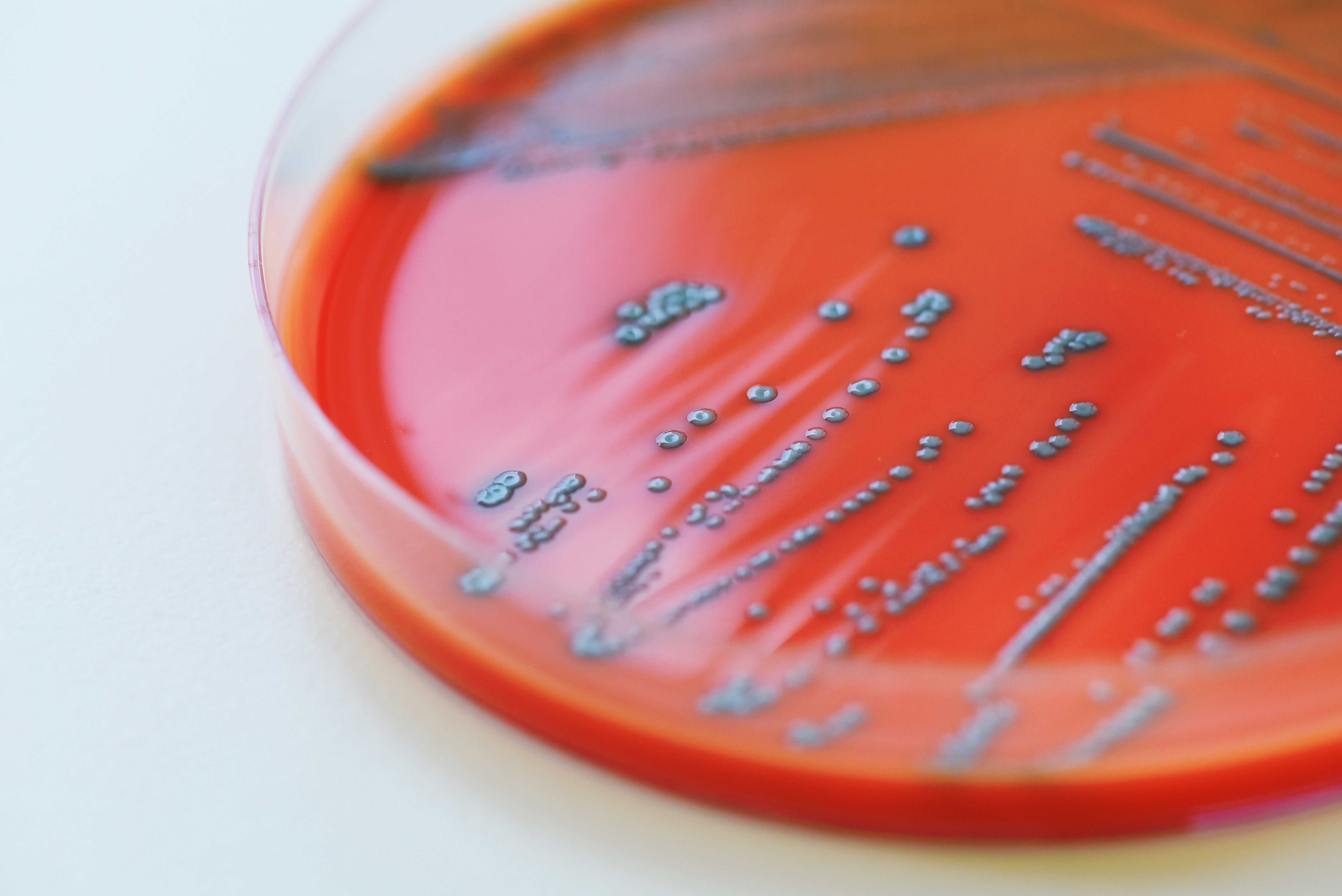 close up van petrischaal met bacterie