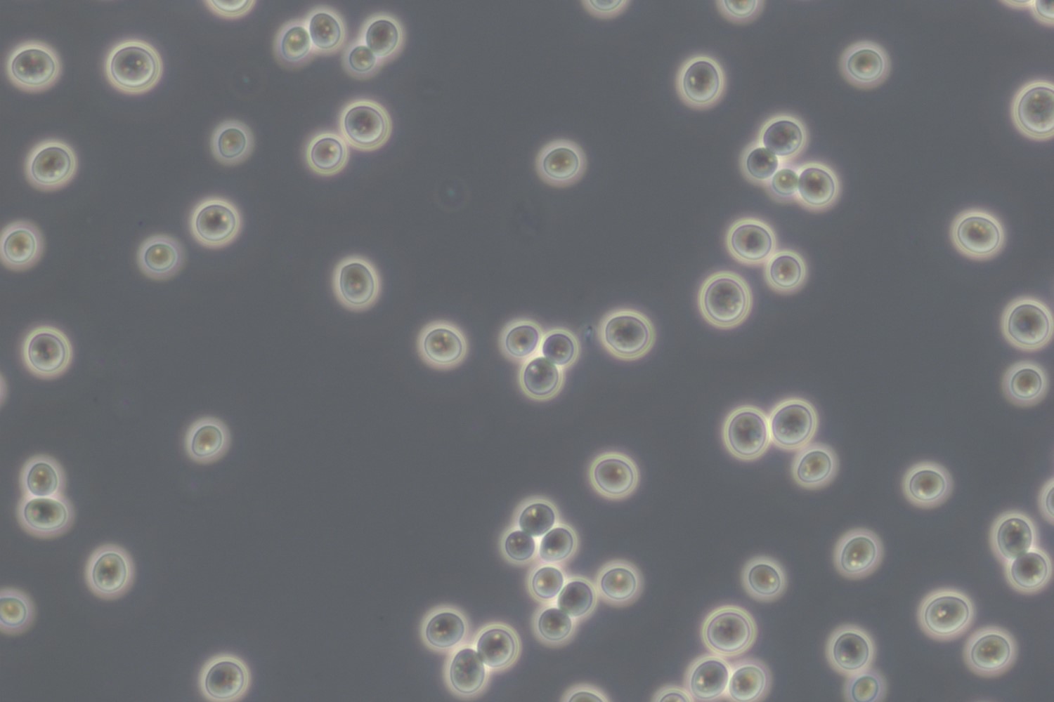 Bakkergist (Saccharomyces cerevisiae) onder de microscoop