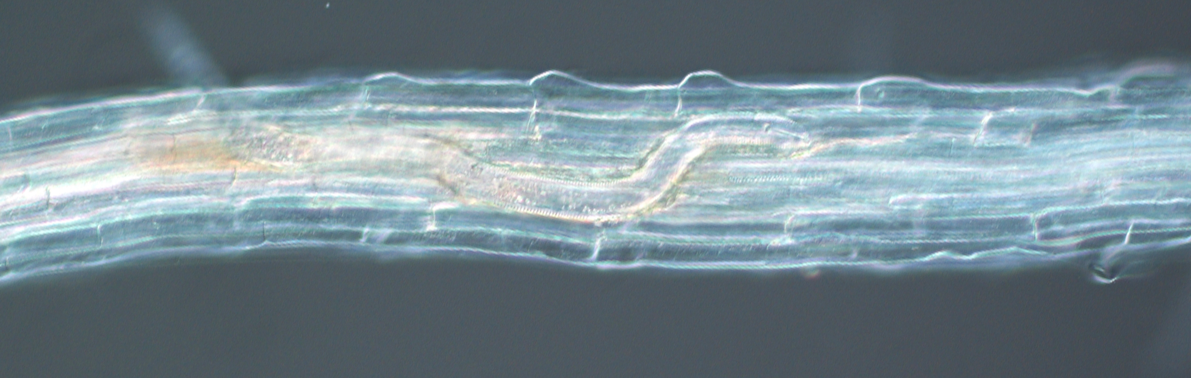 Microscopisch beeld van de nematode Meloidogyne incognita in een plantenwortel