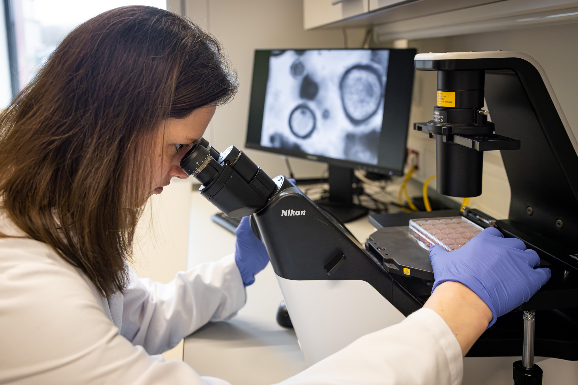 Researcher looks at an organoid through a microscope
