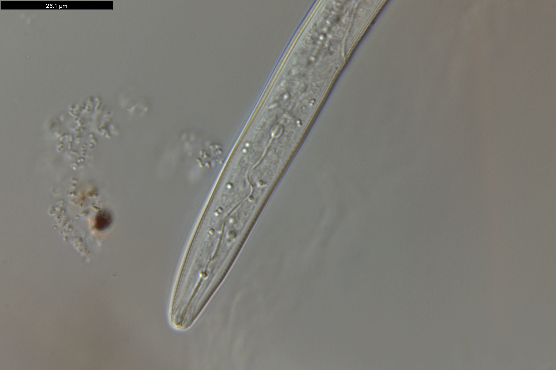 Microscopische afbeelding van Meloidignye Chitwoodi