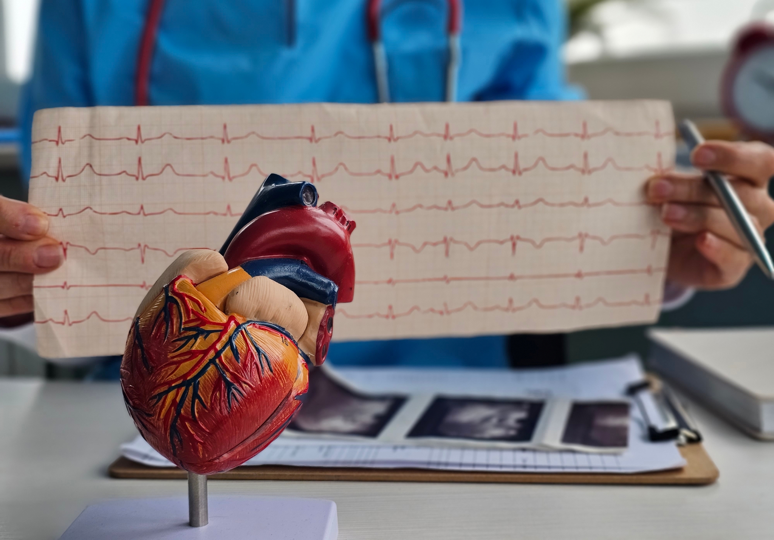 Mitochondriale en NAD⁺ stofwisseling bij verouderingsgerelateerde atriumfibrillatie en cardiale dysfunctie