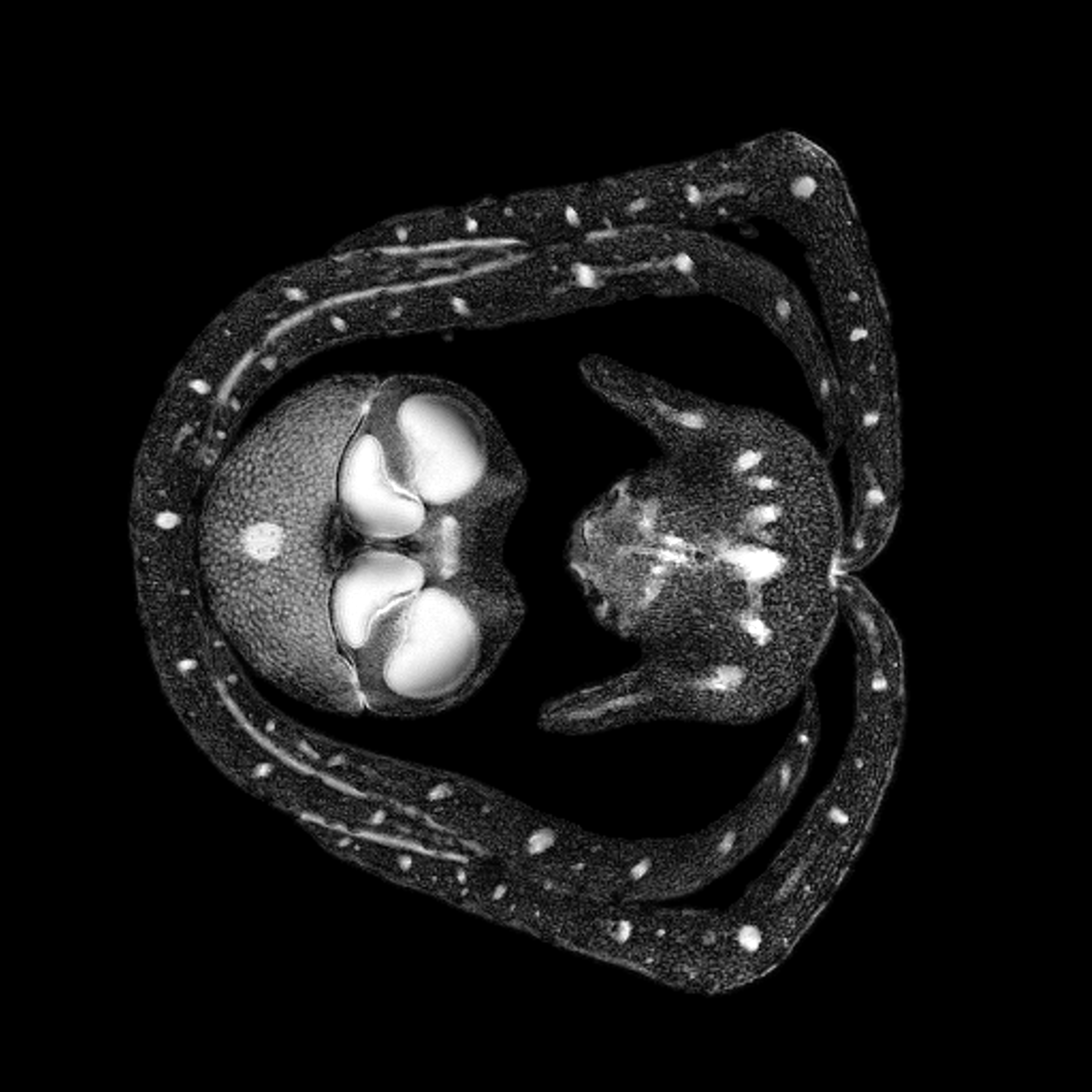 MRI afbeelding van een orchidee.