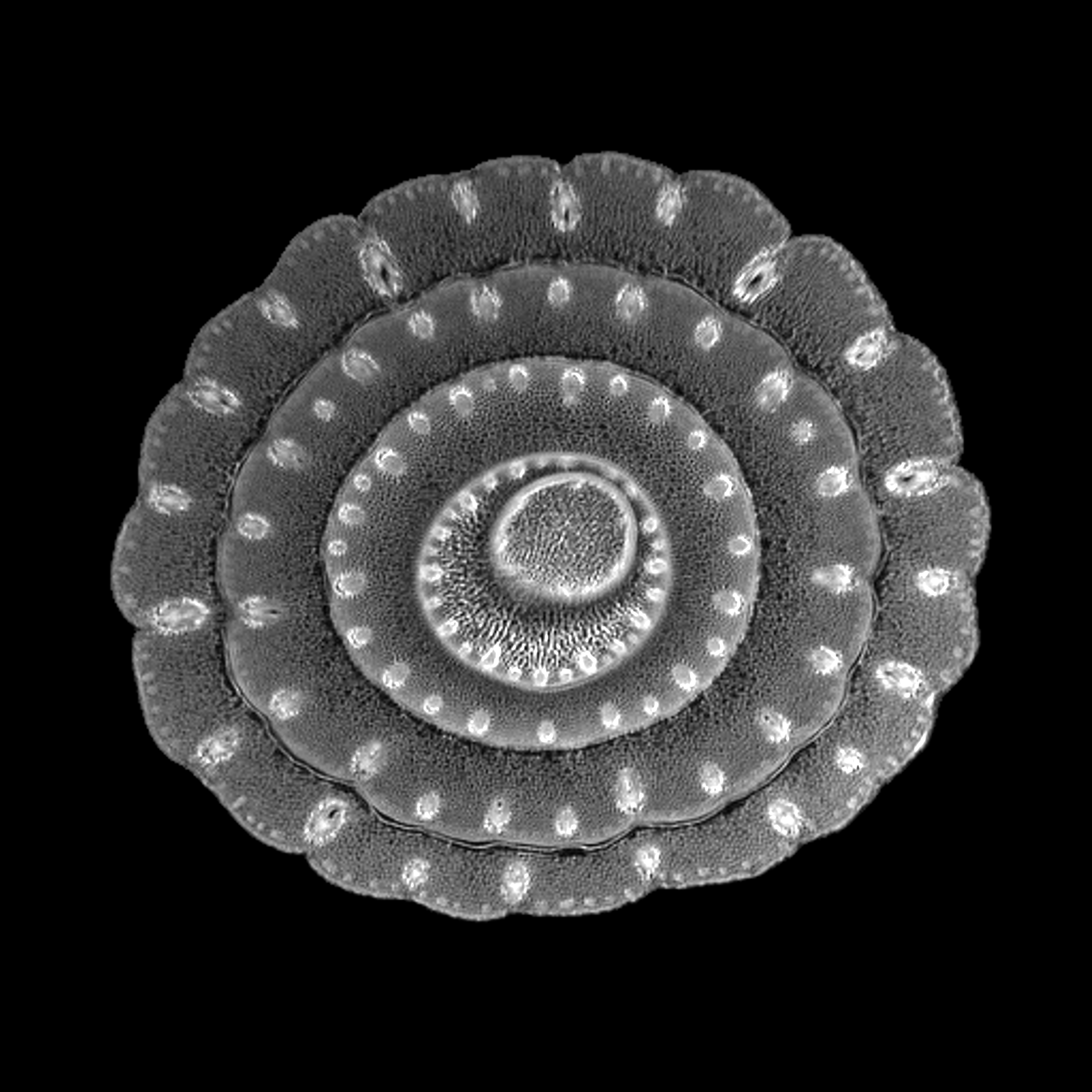 Een MRI dwarsdoorsnede van een bosui