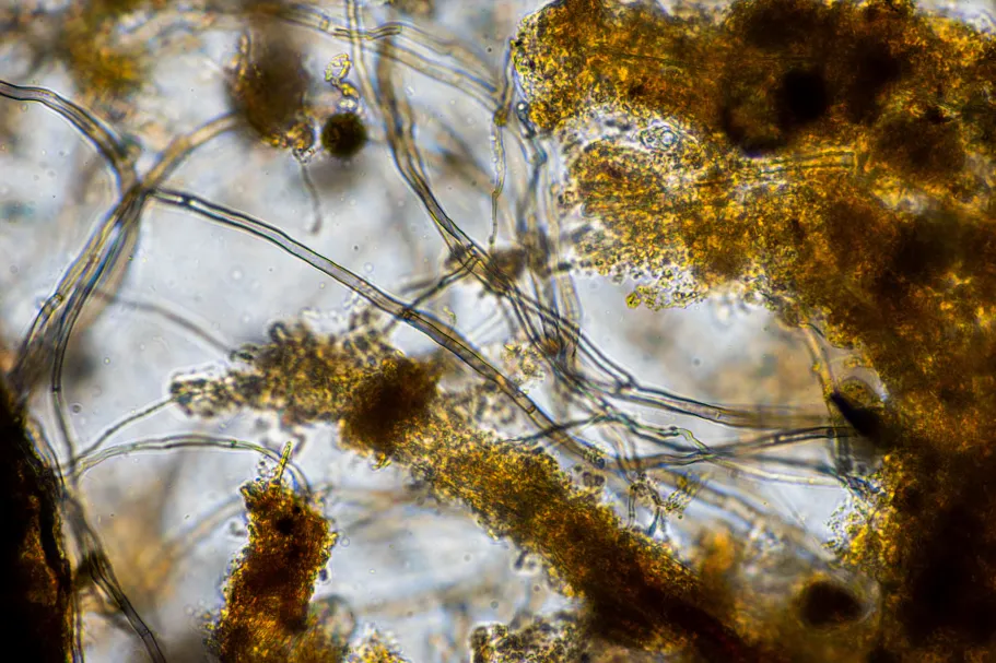 Root microbiomes under stress: from assembly to function