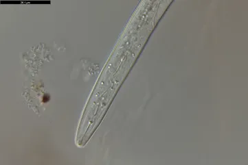 Microscopic picture of Meloidignye Chitwoodi